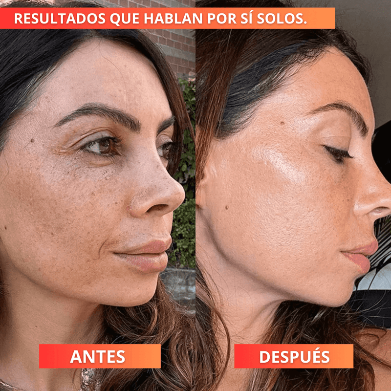 VitalCollagen™ - x6 Parches de Colágeno Anti-Edad