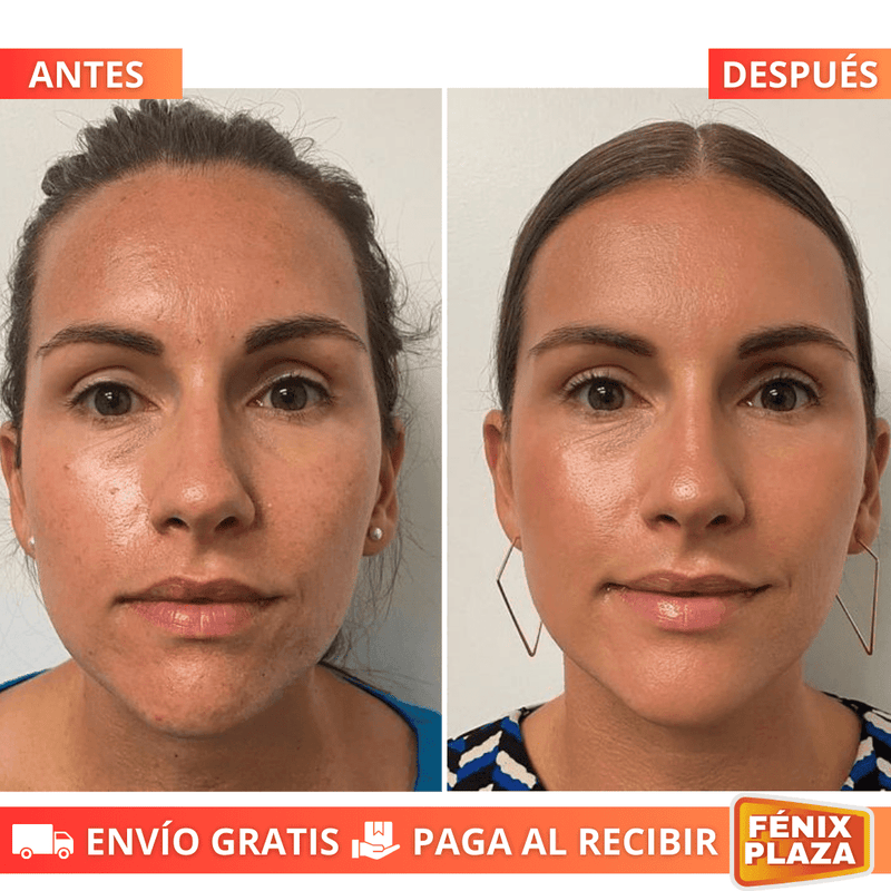 EternaGlow™ Reductor Arrugas y Papada