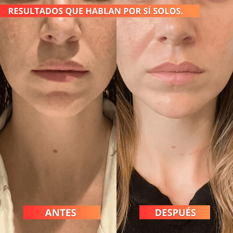 VitalCollagen™ - x6 Parches de Colágeno Anti-Edad