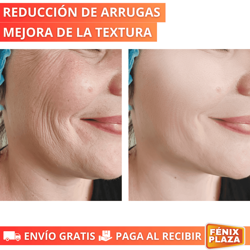 EternaGlow™ Reductor Arrugas y Papada