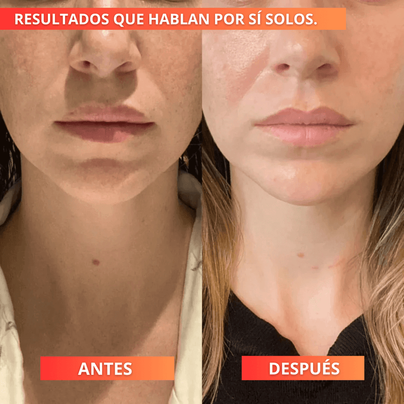 x5 VitalCollagen™ - Anti-Edad + Sérum de Arroz Iluminador