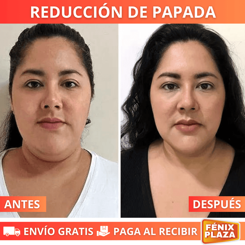 EternaGlow™ Reductor Arrugas y Papada